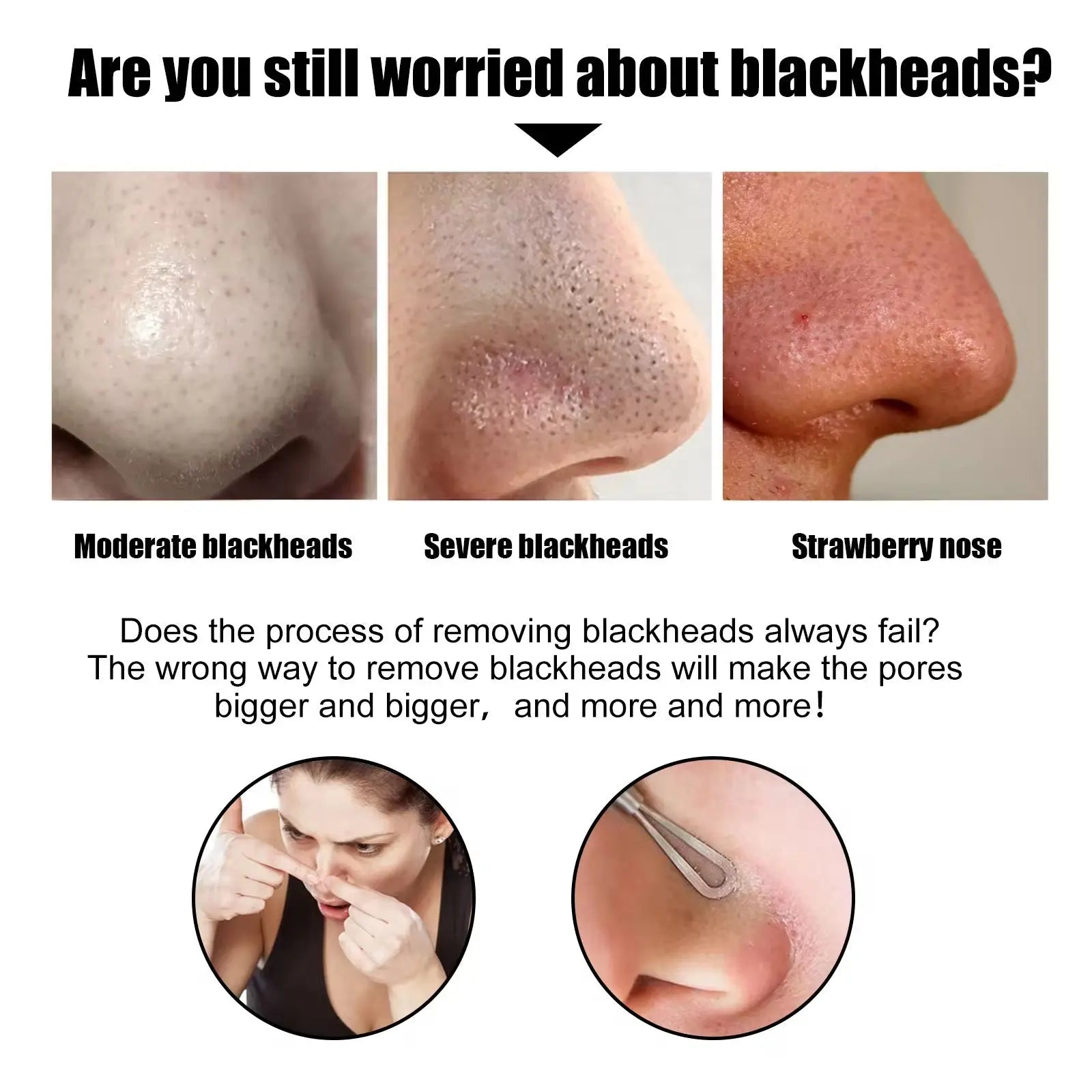 Charcoal Blackhead Remover Nose Strips Deep Cleansing Pore Purifying Nose Patches (10 PCS)