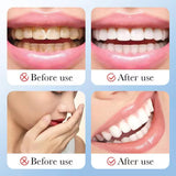 SADOER Toothpaste Tablets Portable Whitening & Fresh Breath Chewable Toothpaste Tablets (30 Tablets)