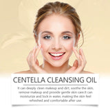 Centella Cleansing Oil Gentle Makeup Remover & Deep Pore Purifying Face Cleanser Soothing Skin Care Oil 100ml SparkelsSparkels