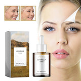 Centella Soothing & Repair Face Serum Hydrating, Calming & Skin Barrier Strengthening (30ml) SparkelsSparkels