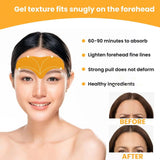 Forehead Wrinkle Patch Hydrating Forehead Care Patches for Smoother-Looking Skin (10 PCS)