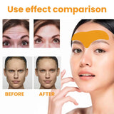 Forehead Wrinkle Patch Hydrating Forehead Care Patches for Smoother-Looking Skin (10 PCS)